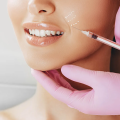 How to Achieve Subtle, Natural Botox Results