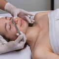 Botox Beyond Wrinkles: Beauty & Wellness Benefits